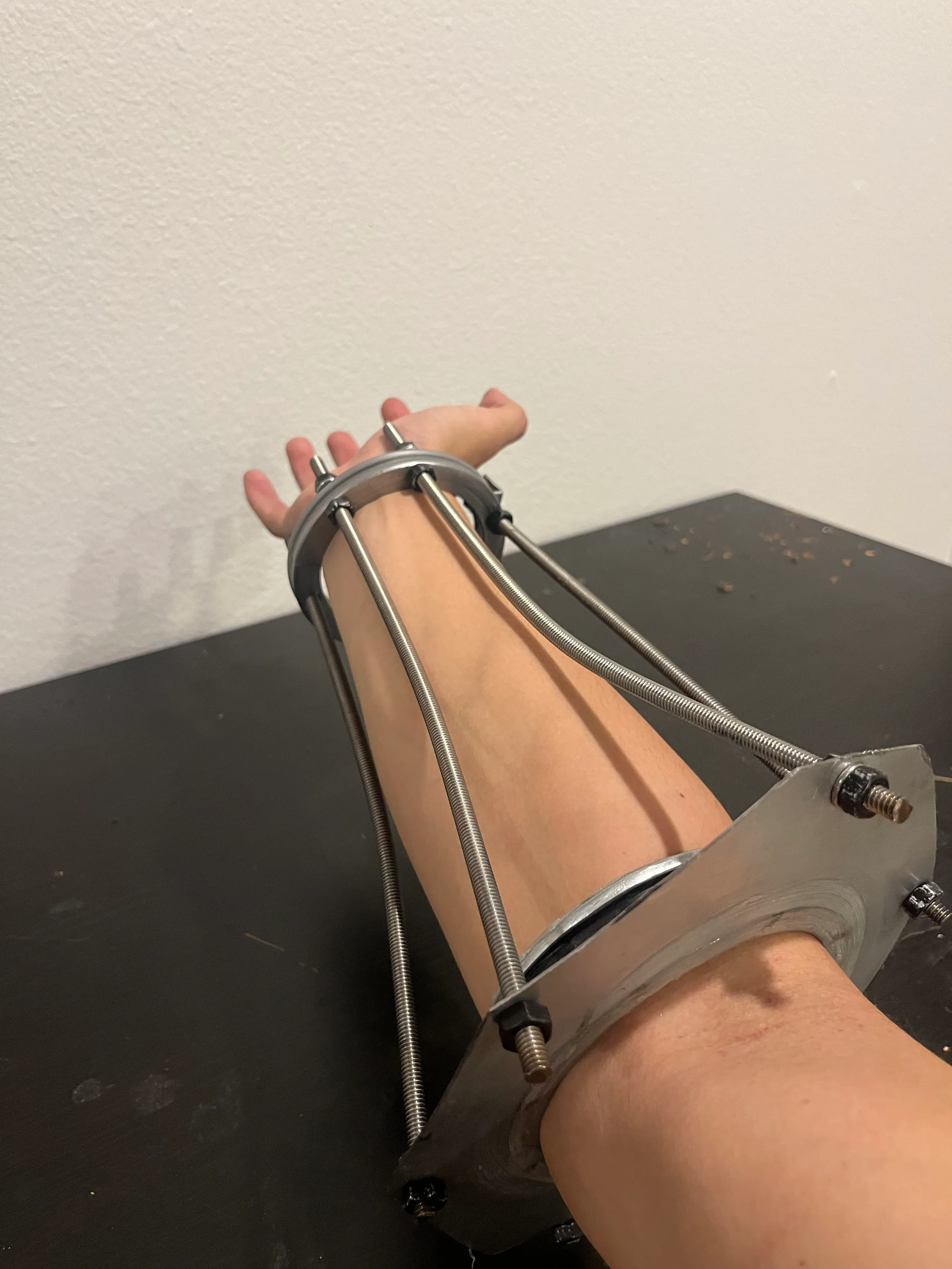 Alt Skeleton on arms